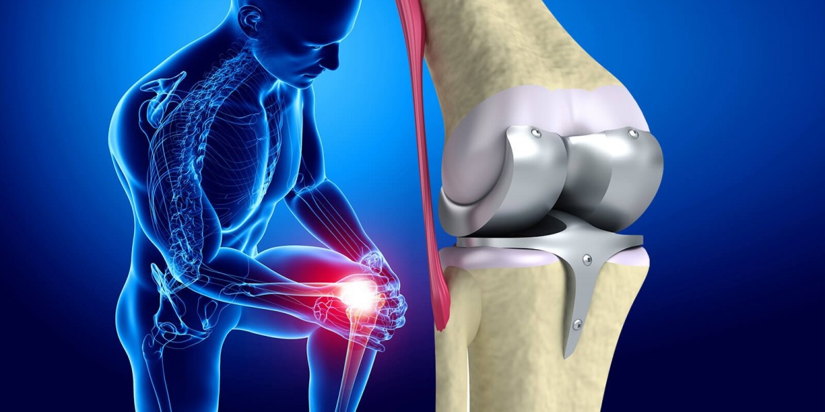 Knee Replacement Market Research on Increasing Adoption of Technologically Advanced Solutions