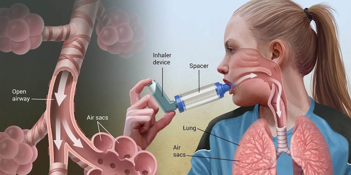 Asthma Inhaler Device Market Research on Rising CAGR of 6.42% During (2022-2030)