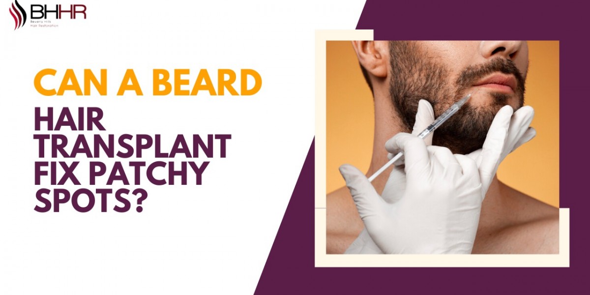 Can a Beard Hair Transplant Fix Patchy Spots?