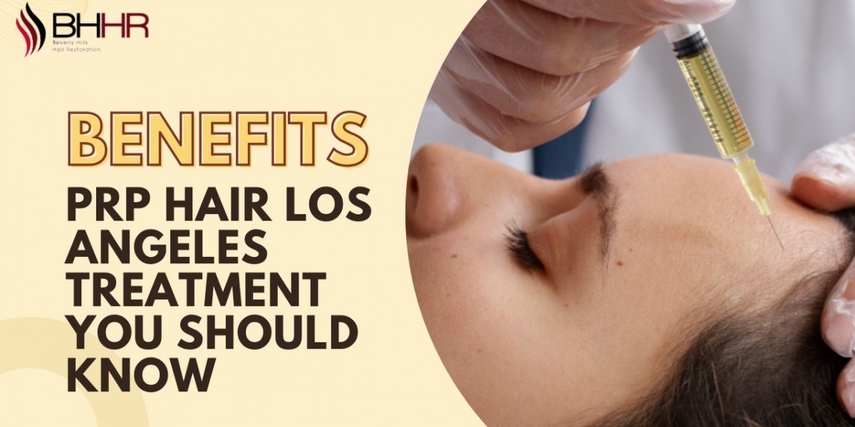 Benefits of PRP Hair Los Angeles Treatment You Should Know