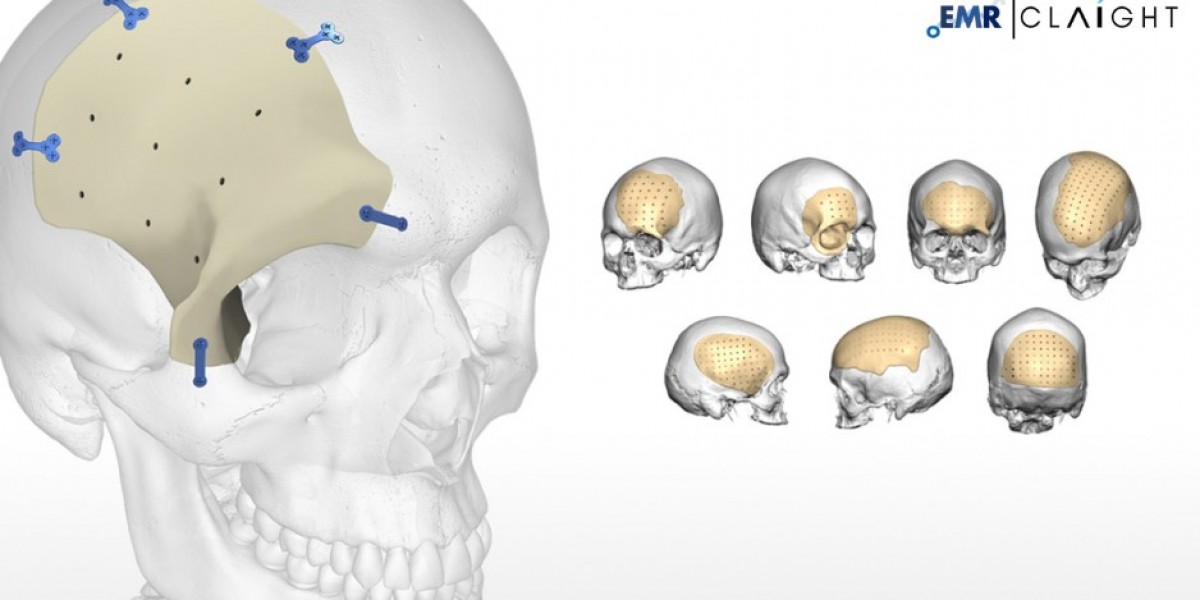 Global Cranial Implants Market Share, Size, & Report, Outlook - 2034