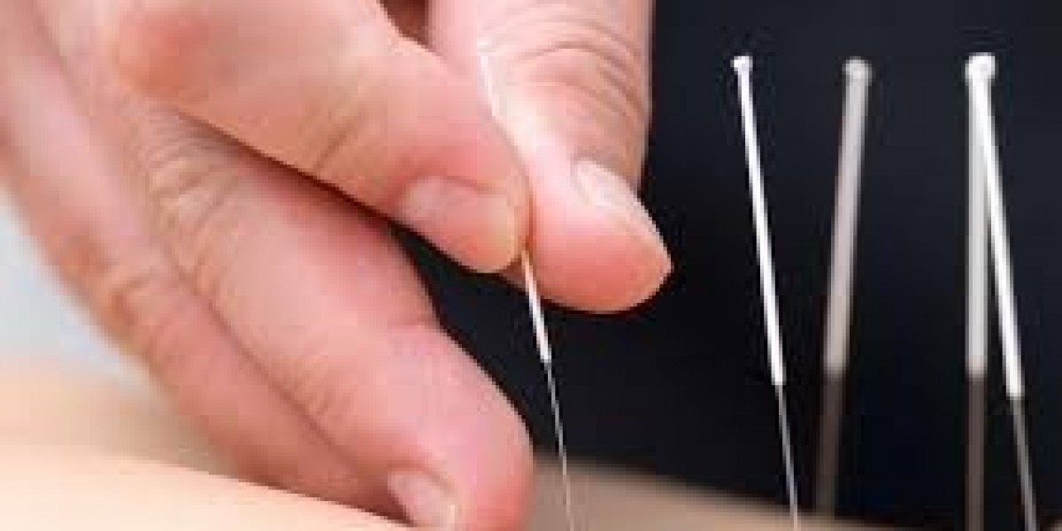 Acupuncture Price vs. Chiropractic & Massage: Cost Comparison & Benefits