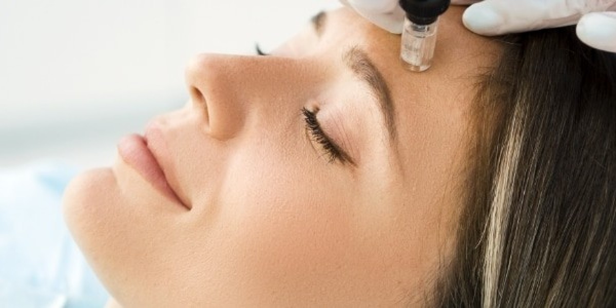 The Benefits of Microneedling in Tucson: What You Need to Know